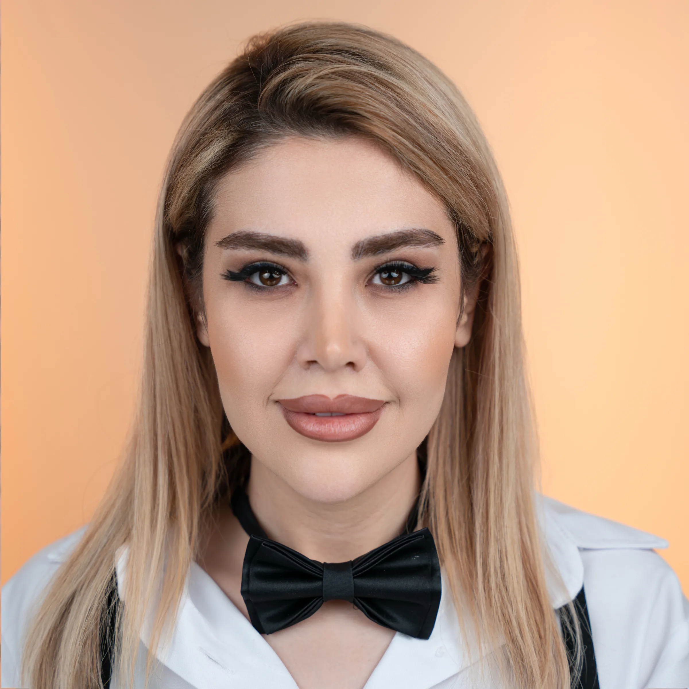 Eyebrow transplant case two, second photo
