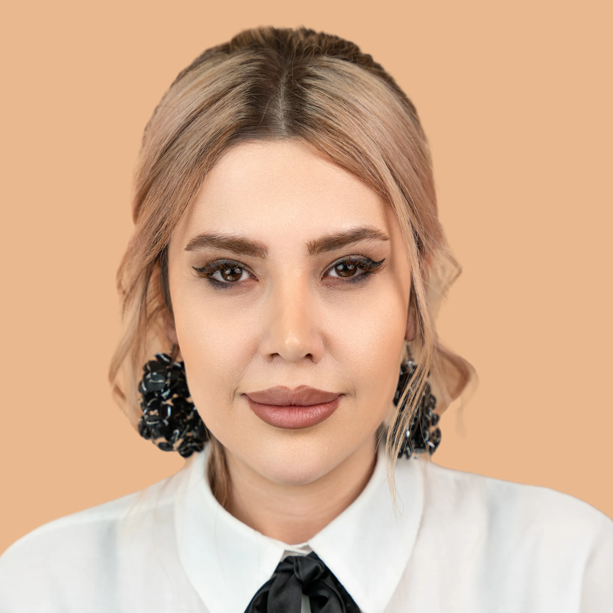 Eyebrow transplant case two, first photo