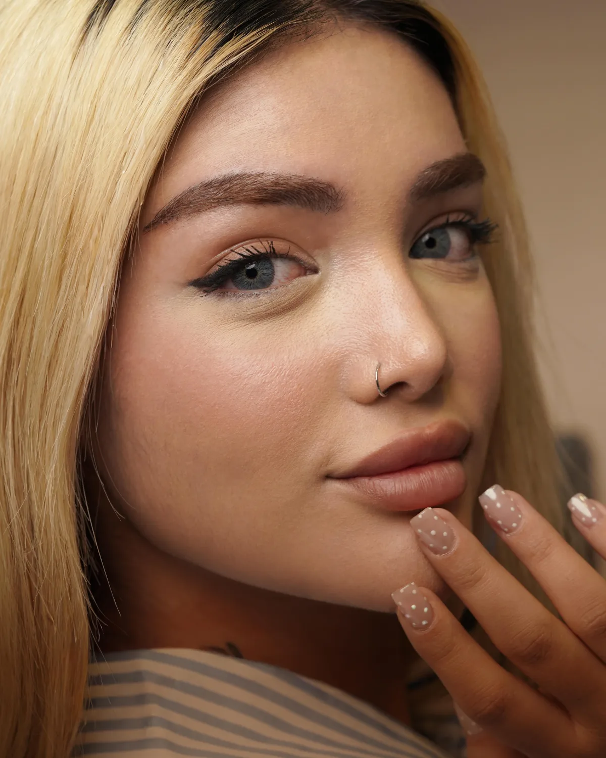 Eyebrow transplant case seven, first photo