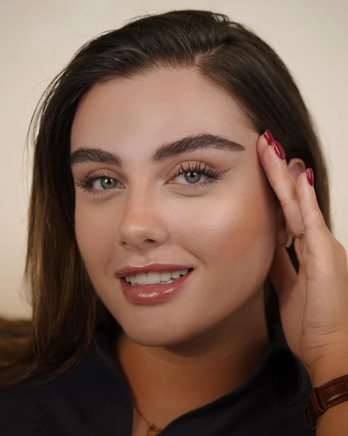 Eyebrow transplant case eight, first photo